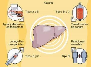 28-julio-2011-dia-mundial-hepatitis-L-Zitgu8